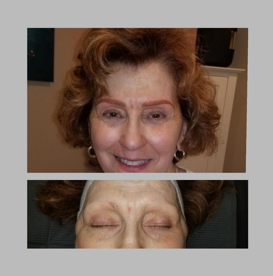 Microblading Before & After